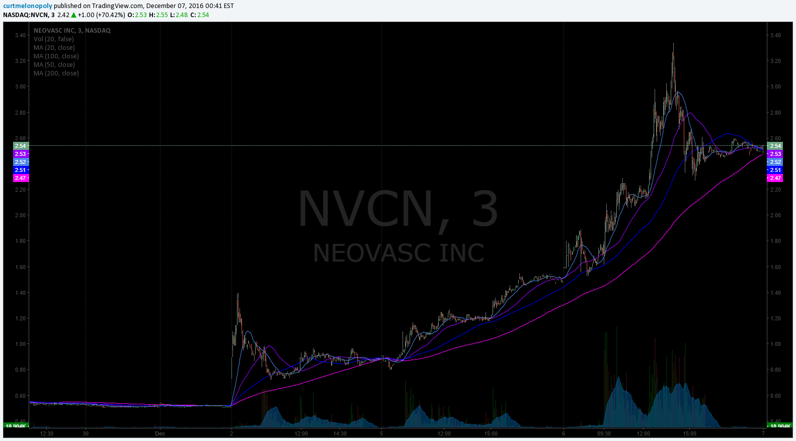 $NVCN, Stock, Watchlist