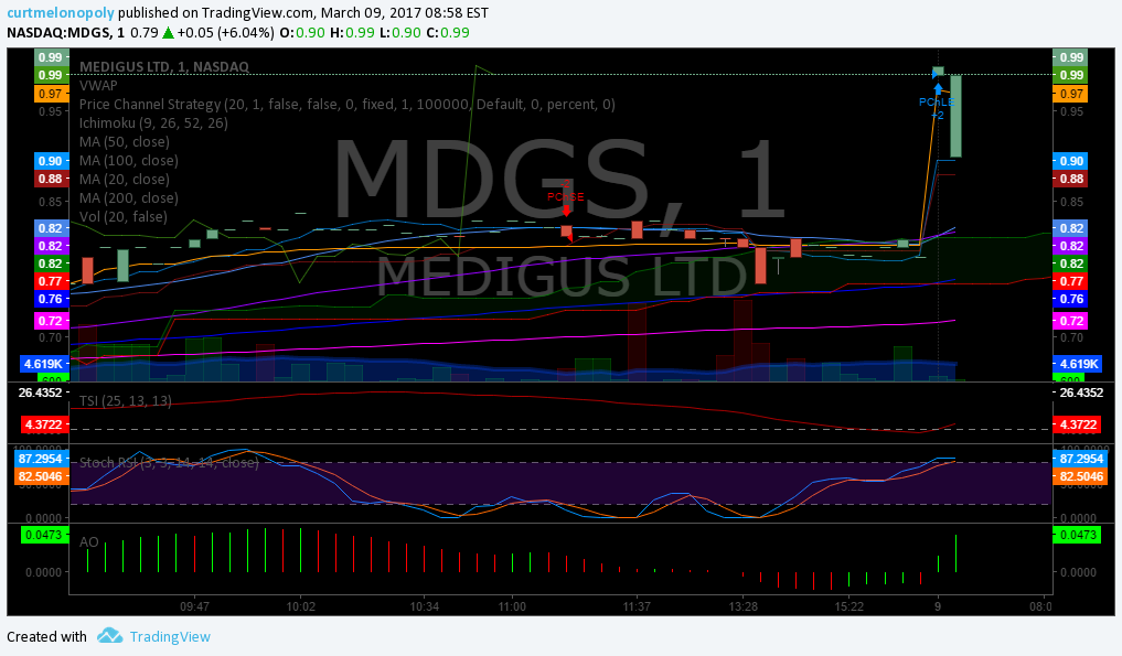 $MDGS, Premarket, Trading, Plan
